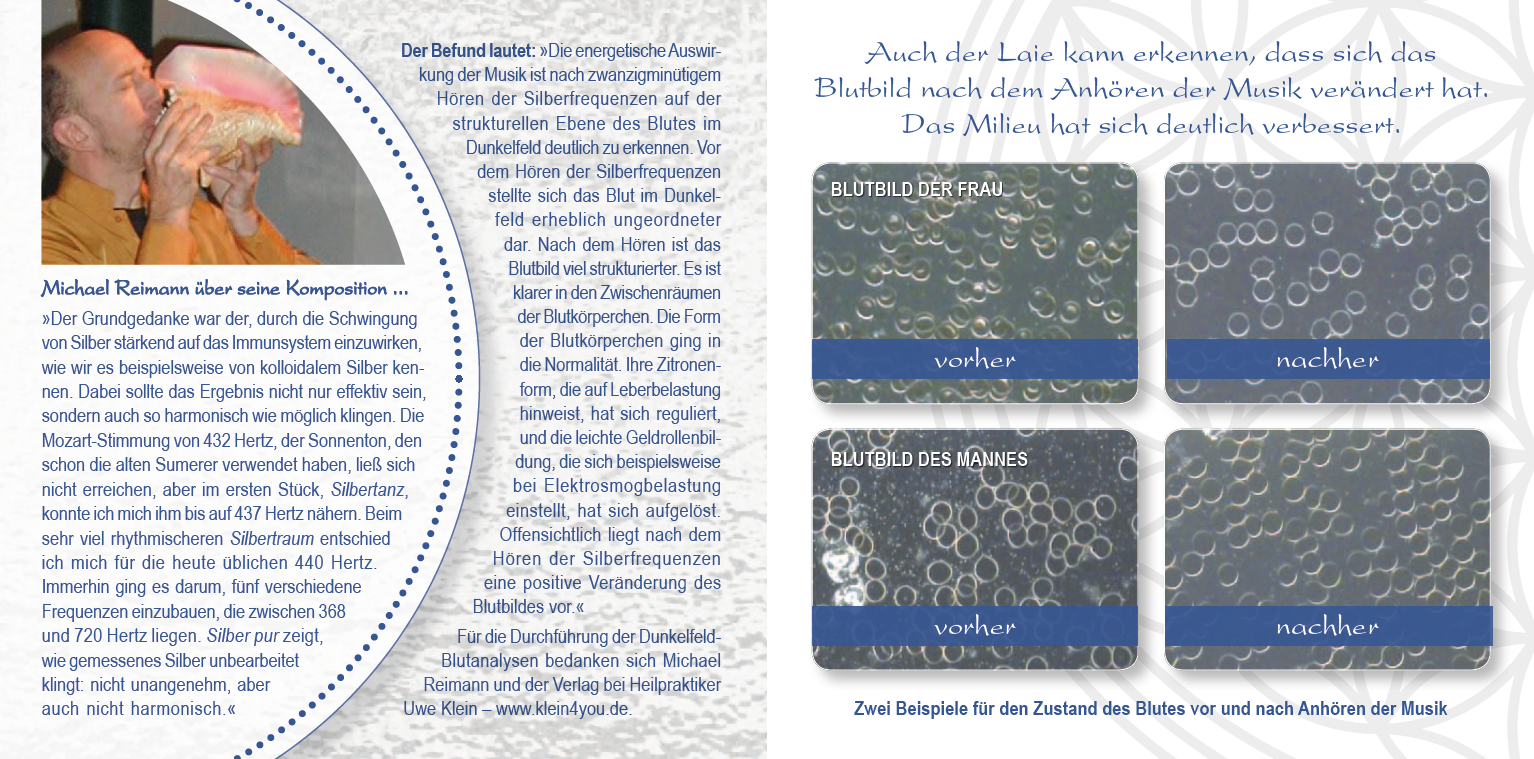 KOLLOIDALES SILBER [Antivirale Frequenzen; wahlweise als Download]